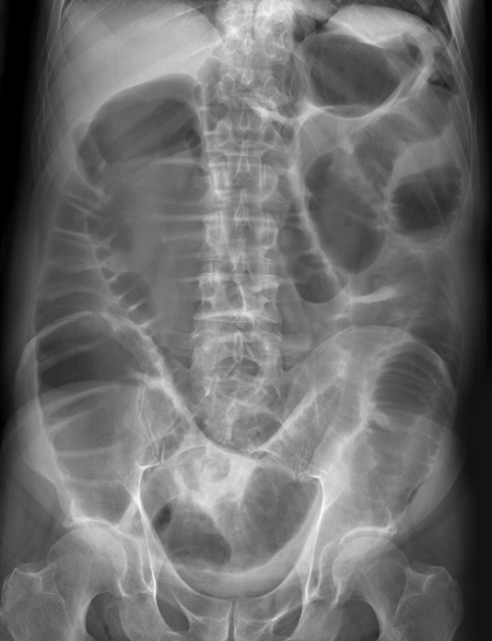 Radiology Masterclass - Test Yourself - Abdominal X-ray Quiz