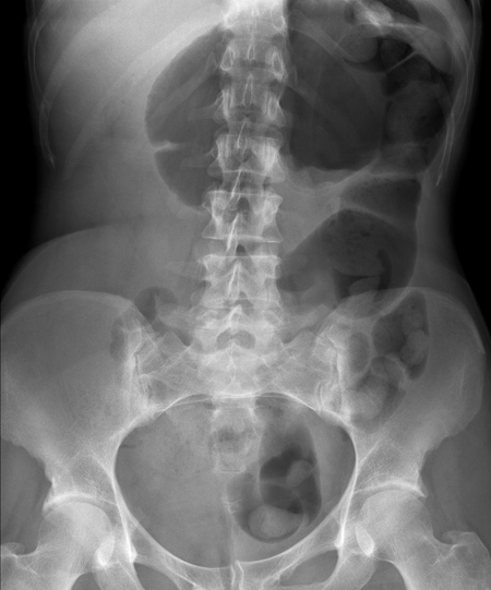 Radiology Masterclass - Test Yourself - Abdominal X-ray Quiz