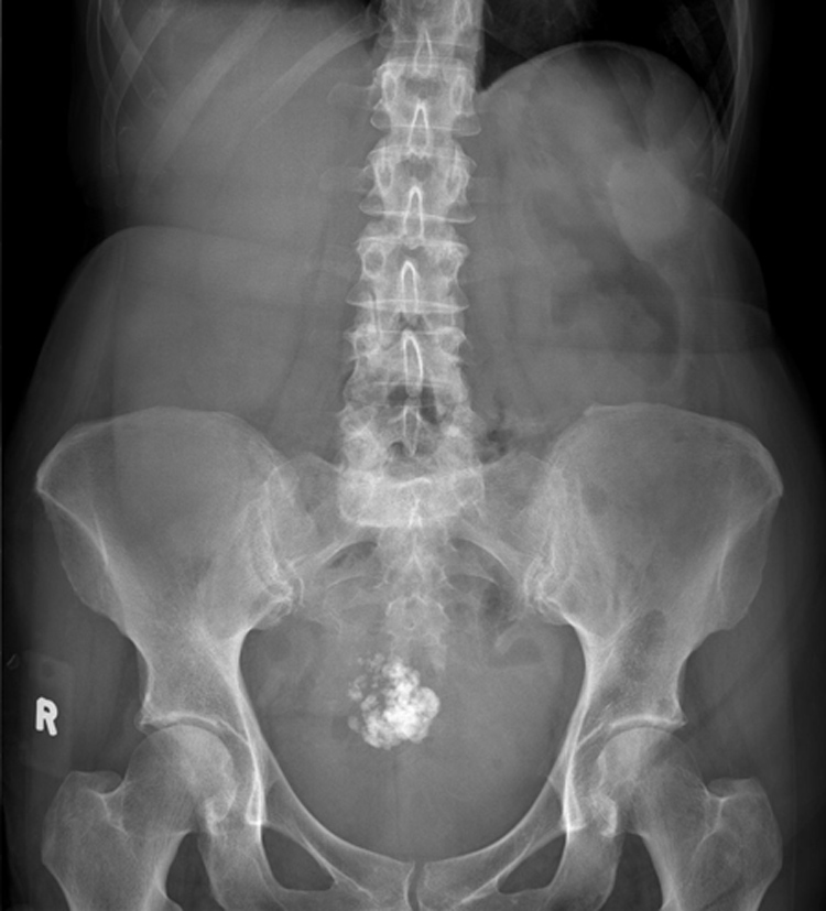 Radiology Masterclass - Test Yourself - Abdominal X-ray Quiz