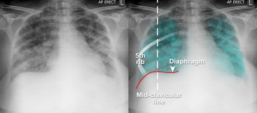 COVID-19 Image Gallery - Quality and systematic approach