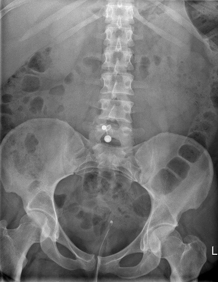 Radiology Masterclass - Test Yourself - Abdominal X-ray Quiz