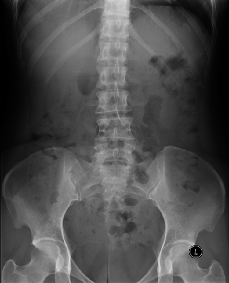 Radiology Masterclass - Test Yourself - Abdominal X-ray Quiz