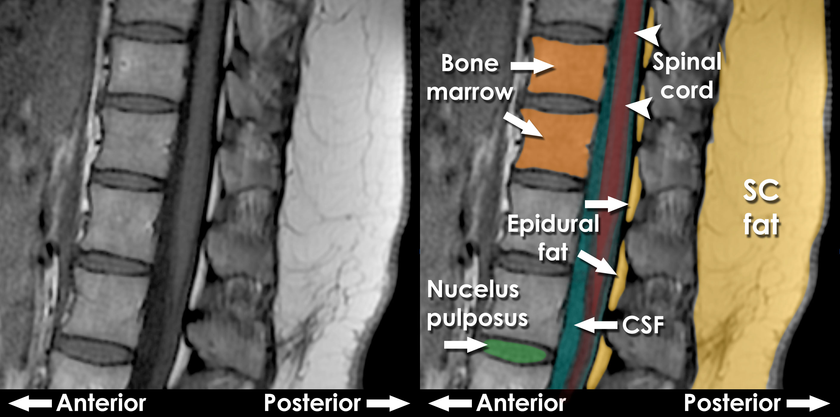 T1 And T2 Mri Signals