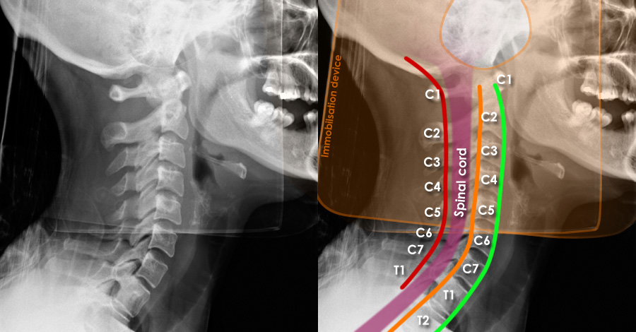 x ray cervical spine cpt code