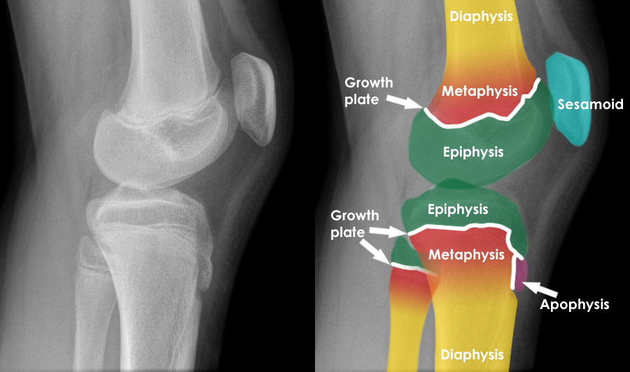 Musculoskeletal X ray General principles Bone anatomy