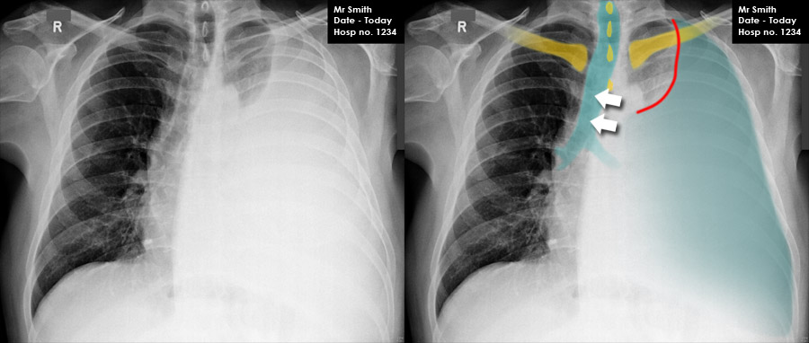 Chest X-ray - Scenario 2 - Scenario image interpretation