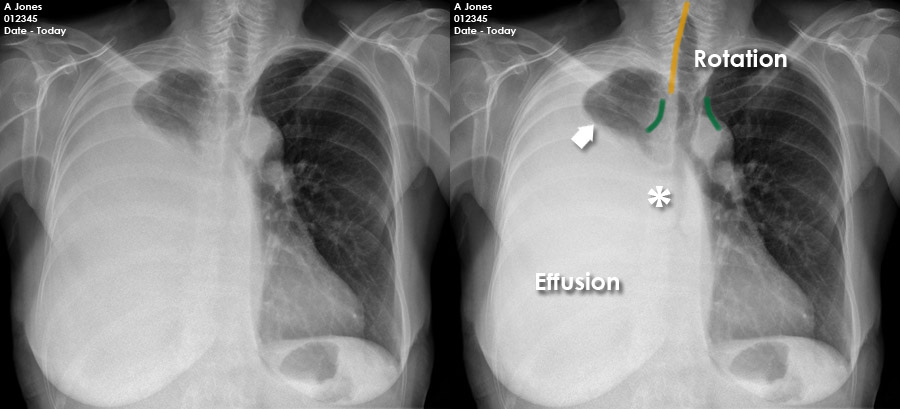 Chest X-ray - Scenario 3 - Scenario image interpretation
