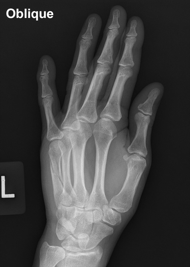 right hand x ray anatomy